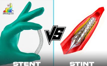 Difference Between Stent and Stint