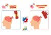 Difference Between Ischemic and Hemorrhagic Stroke