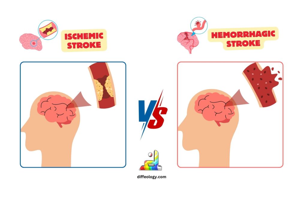 Difference Between Ischemic And Hemorrhagic Stroke | Diffeology