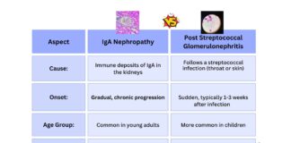 Difference Between IgA Nephropathy and Post-Streptococcal Glomerulonephritis