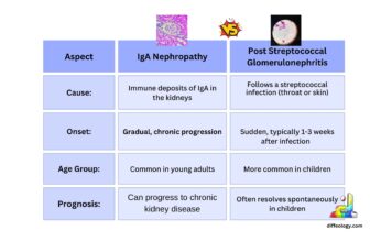 Difference Between IgA Nephropathy and Post-Streptococcal Glomerulonephritis