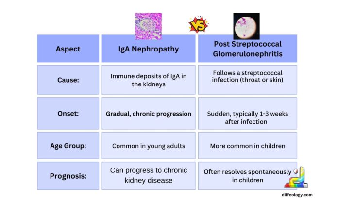 Difference Between IgA Nephropathy and Post-Streptococcal Glomerulonephritis