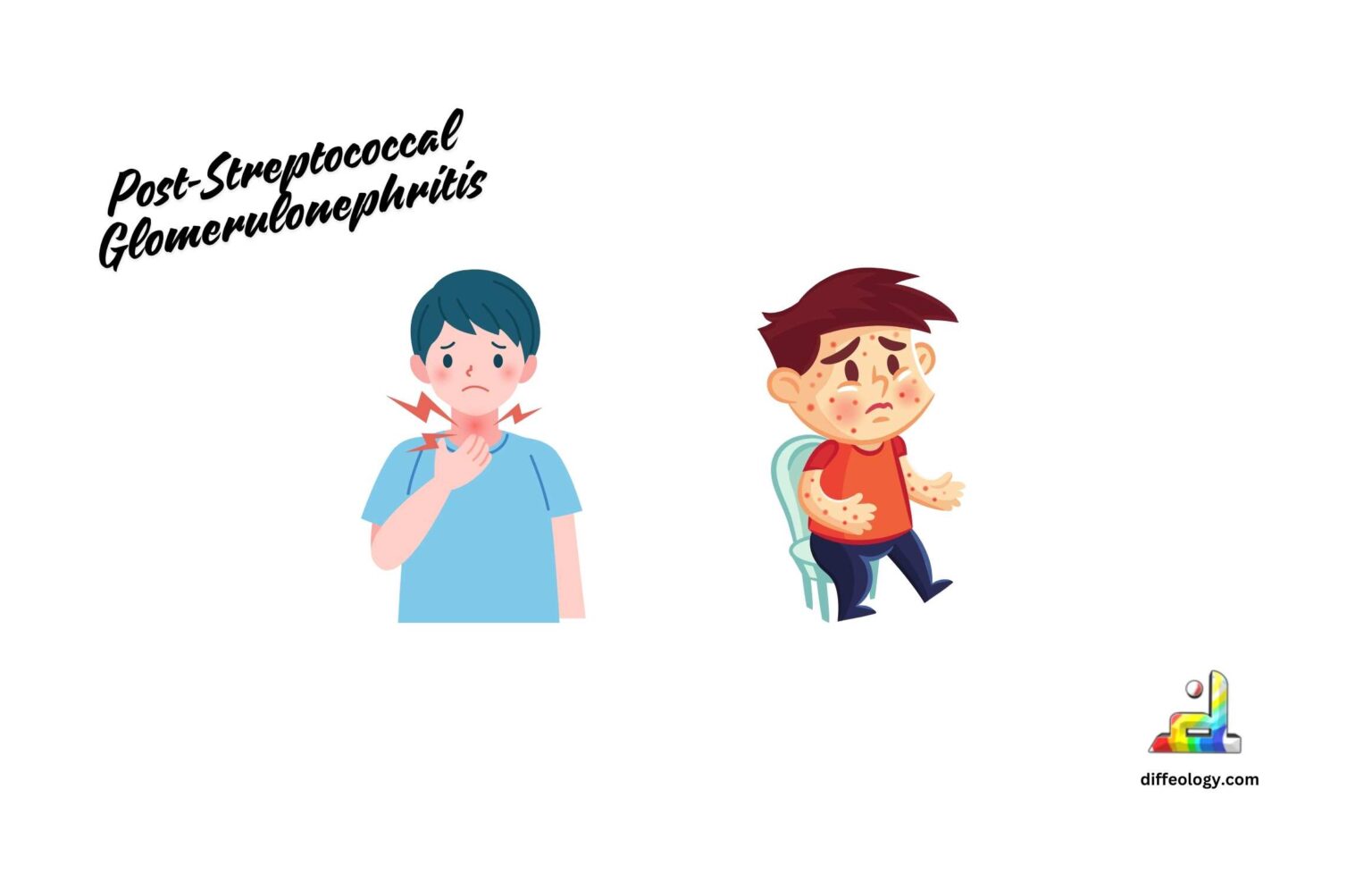 Psgn Difference Between IgA Nephropathy And Post-Streptococcal ...