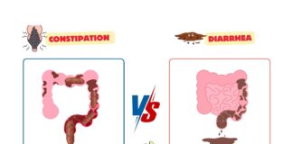 Difference Between Constipation and Diarrhea