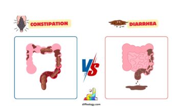 Difference Between Constipation and Diarrhea