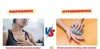 Difference Between Diaphoresis and Hyperhidrosis