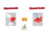 Difference Between Hypotonic and Hypertonic