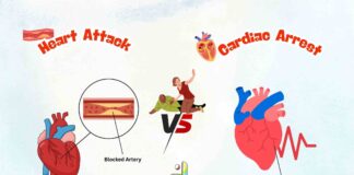 Difference Between Heart Attack and Cardiac Arrest